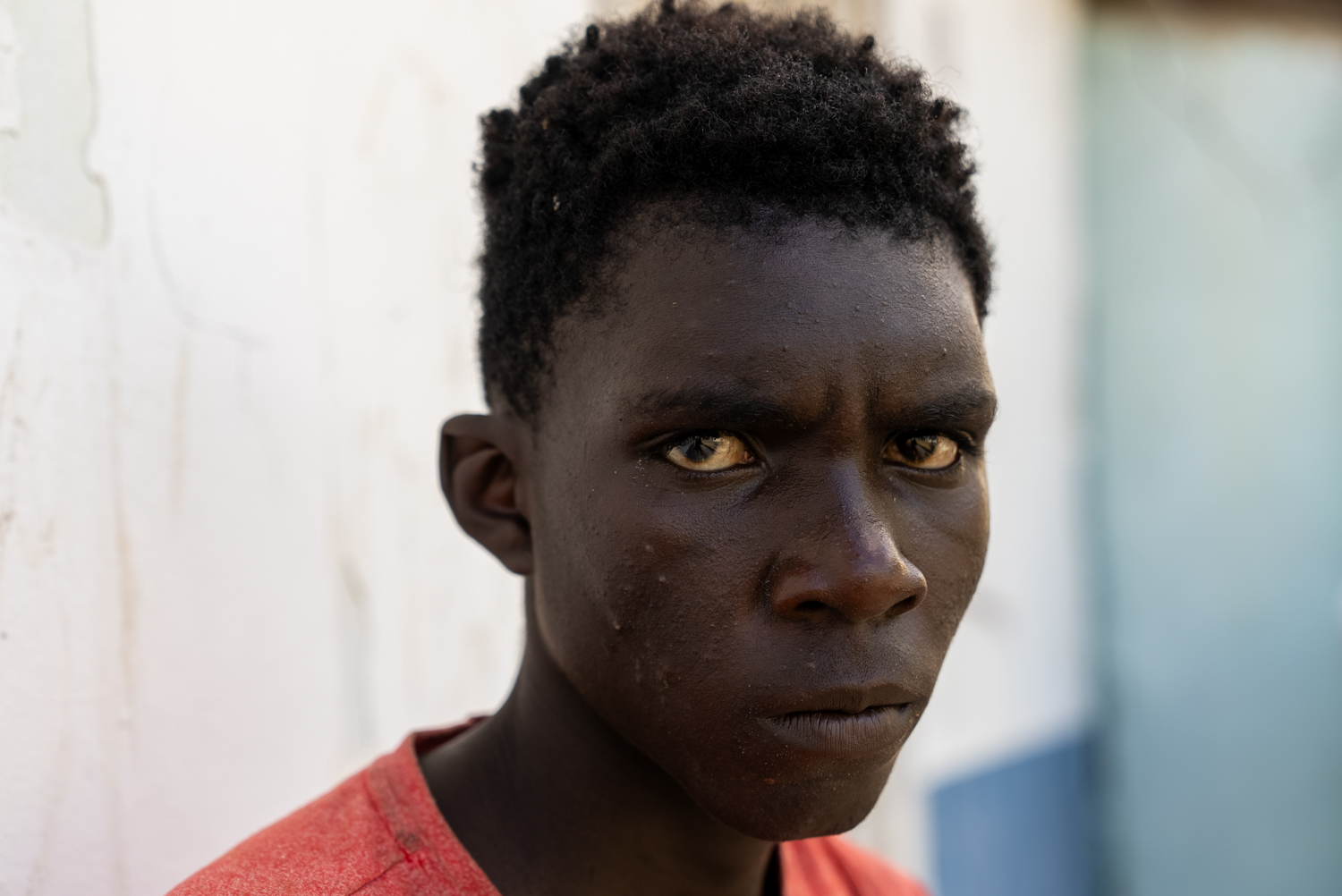 A tight close-up portrait of a teenage boy looking directly into the camera with a serious, intense expression. His eyes have a yellowish tinge; the background is softly blurred white and blue.
